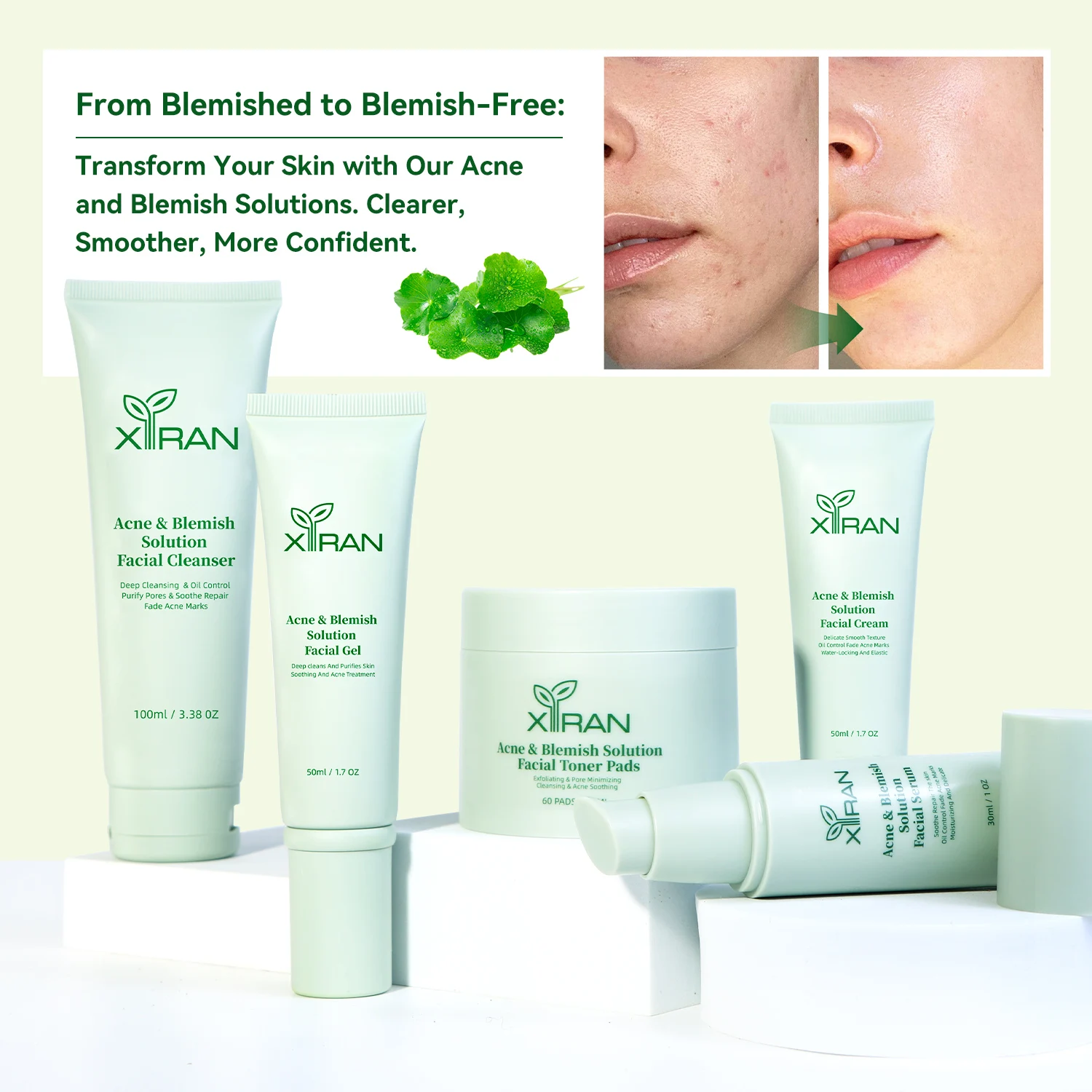 CICA Anti Acne Skincare Set